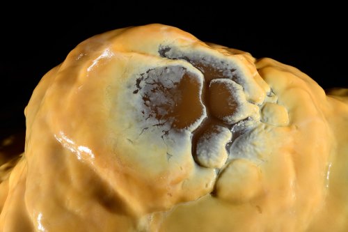 Grotte de Dargilan (Aveyron) - Salle du chaos : haut d'une coulée stalagmitique jaune or (SP-21-1517)